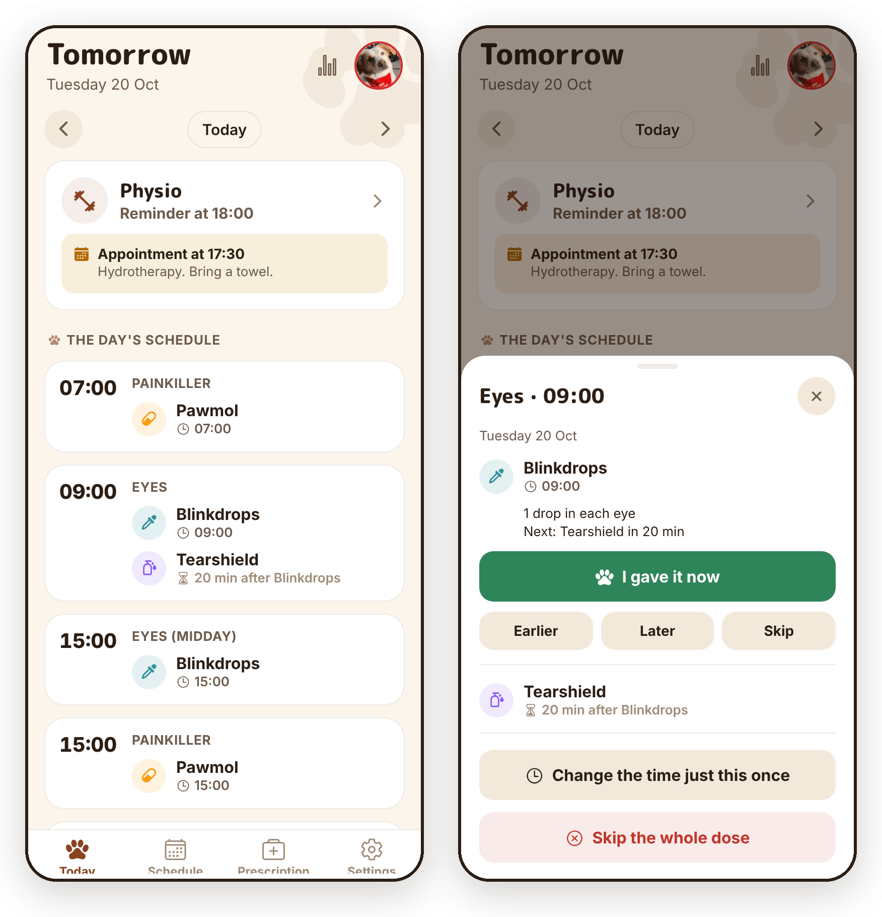 Left: tomorrow's doses, one by one. Right: tapping the 09:00 Eyes dose gives "Earlier", "Later" and "Skip", "Change the time just this once" and "Skip the whole dose".